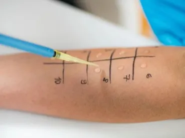 Ataköy Alerji Testi Cihazı